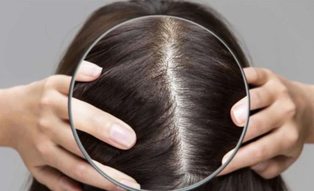 Epigenetic hair and scalp analysis at Magnolia Medical Group