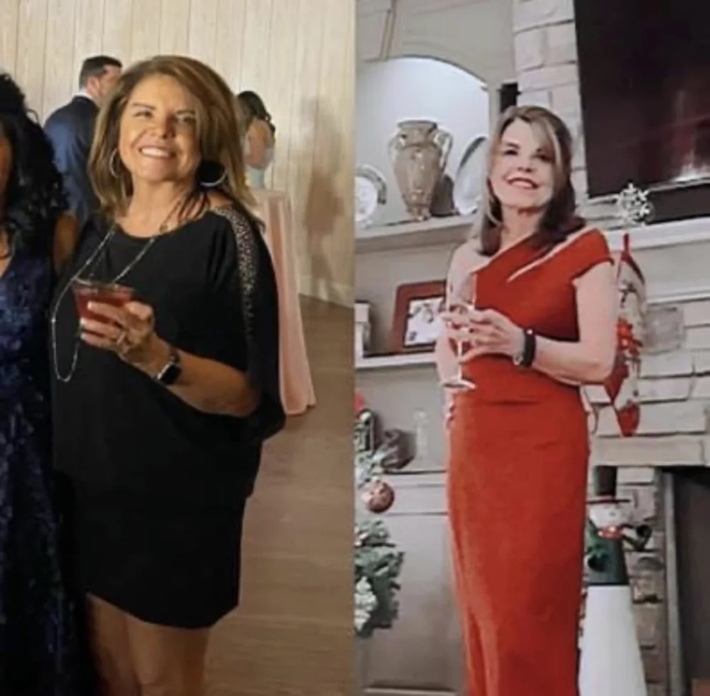 Before and after results from the medical weight-loss program at Magnolia Medical Group